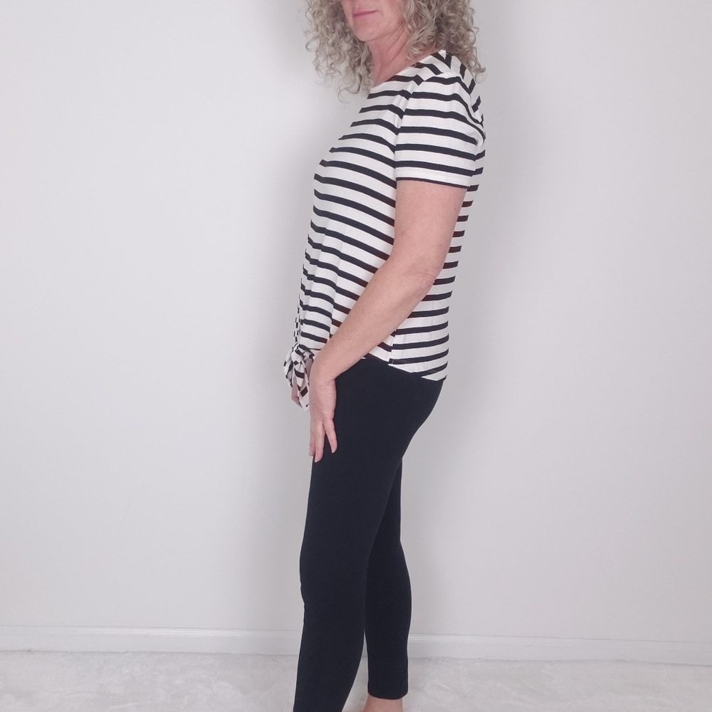 MARLED STRIPE TOP Button Detail - Picture 4 of 7